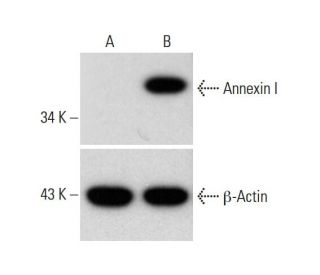 Annexin I Antibody (EH17a) - Western Blotting - Image 321865