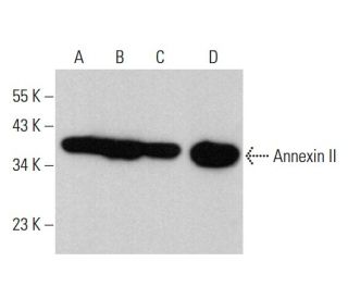 Annexin-2/ANXA2 Antibody (3D5) - Western Blotting - Image 379815 