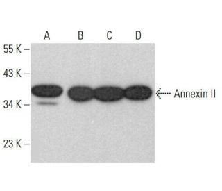 Annexin-2/ANXA2 Antibody (E-11) - Western Blotting - Image 352046 