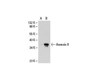 Annexin II (3D5): sc-47696. Western blot analysis of Annexin II... 