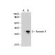 Annexin II (3D5): sc-47696. Western blot analysis of Annexin II... 