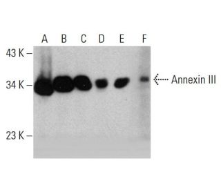 Annexin III Antibody (21) - Western Blotting - Image 384486 