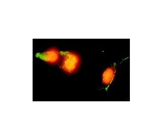 Annexin V FITC (FL): sc-4252 FITC. Immunofluorescence staining of UV-irradiated A-431 cells showing Annexin V FITC (green)