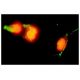 Annexin V FITC (FL): sc-4252 FITC. Immunofluorescence staining of UV-irradiated A-431 cells showing Annexin V FITC (green)
