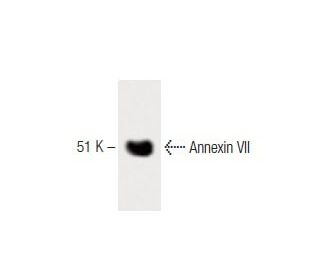 Annexin VII Antibody (5) - Western Blotting - Image 60236 