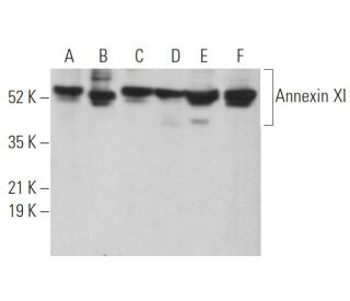 Annexin XI Antibody (E-10) - Western Blotting - Image 372853 
