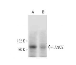 ANO2 Antibody (D-2) - Western Blotting - Image 291842 