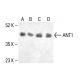 ANT1 Antibody (E-7) - Western Blotting - Image 411855