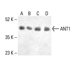 ANT1 Antibody (E-7) - Western Blotting - Image 411855The Double Nickase Plasmid features a U6 promoter for sgRNA expression, a 20 nt targeting sequence, and a gRNA scaffold to guide Cas9n. It includes a CBh promoter for Cas9n (D10A) and puromycin resistance, GFP for transfection verification, and nuclear localization signals (NLS). The 2A peptide allows co-expression of Cas9n and Puro from a single promoter, enabling precise genome editing with reduced off-target effects.