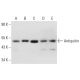 Antiquitin Antibody (A-7) - Western Blotting - Image 317967 