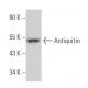 Antiquitin Antibody (A-7) - Western Blotting - Image 367736