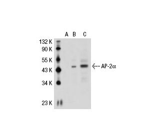 AP-2&alpha; Antibody (G8/5) - Western Blotting - Image 30257 