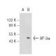 AP-2α/β Antibody (3H547) - Western Blotting - Image 44828 