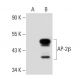 AP-2β Antibody (1F3/8) - Western Blotting - Image 30149