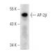 AP-2β Antibody (1G6/2) - Western Blotting - Image 14270 