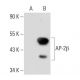 AP-2β Antibody (1G6/2) - Western Blotting - Image 30147