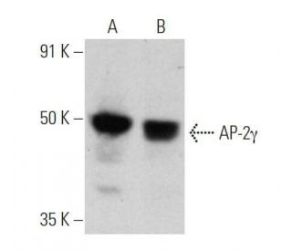 AP-2&gamma; Antibody (6E4/4) - Western Blotting - Image 355246 