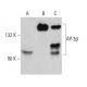 AP-3β Antibody (3B4) - Western Blotting - Image 384459 