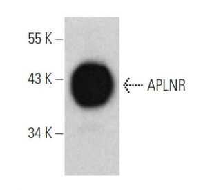 APLNR Antibody (3C3-7) - Western Blotting - Image 374608The Double Nickase Plasmid features a U6 promoter for sgRNA expression, a 20 nt targeting sequence, and a gRNA scaffold to guide Cas9n. It includes a CBh promoter for Cas9n (D10A) and puromycin resistance, GFP for transfection verification, and nuclear localization signals (NLS). The 2A peptide allows co-expression of Cas9n and Puro from a single promoter, enabling precise genome editing with reduced off-target effects.