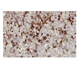 apoA-II Antibody (ZZ6) - Immunohistochemistry - Image 36361