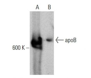 apoB Antibody (A-6) - Western Blotting - Image 387966Each CRISPR/Cas9 Knockout (KO) Plasmid product consists of a pool of 3 plasmids designed to ensure identification and cleavage of a specific gene for maximum knockout efficiency. Each plasmid encodes a unique 20 nt sequence derived from the GeCKO (v2) library.