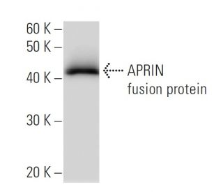 APRIN Antibody (2030D32a) - Western Blotting - Image 47953