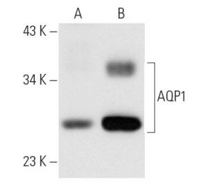 Aquaporin 1/AQP1 Antibody (1/22) - Western Blotting - Image 10508 
