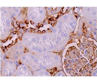 Aquaporin 2/AQP2 Antibody (E-2) - Immunohistochemistry - Image 368887 