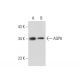 Aquaporin 8/AQP8 Antibody (14-Z) - Western Blotting - Image 301134 
