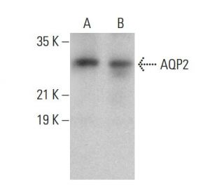 Aquaporin 2/AQP2 Antibody (G-3) - Western Blotting - Image 379037 