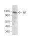 Androgen Receptor Antibody (AN1-15) - Western Blotting - Image 380820