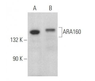 ARA160 Antibody (C-10) - Western Blotting - Image 369343 