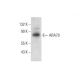 ARA70 Antibody (C-4) - Western Blotting - Image 300514 