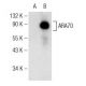 ARA70 (C-4): sc-373739. Western blot analysis of ARA70 expression in non-transfected: sc-117752 (A) and human ARA70 transf