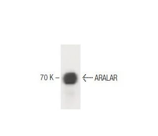ARALAR Antibody (8) - Western Blotting - Image 60243 