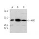 ARD Antibody (H-3) - Western Blotting - Image 375577 