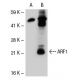 ARF1 Antibody (ARFS 5F2/2) - Western Blotting - Image 39502