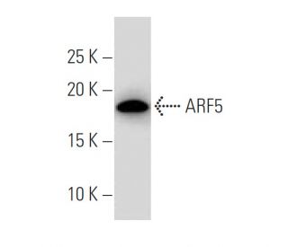 ARF5 Antibody (14-07) - Western Blotting - Image 33543 