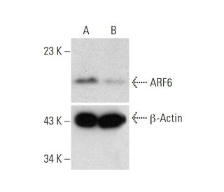 ARF6 Double Nickase Plasmid (h): sc-400799-NIC-2. Western blot analysis of... 
