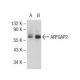 ARFGAP2 Antibody (RG-7) - Western Blotting - Image 72701 