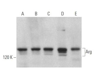 Arg Antibody (1H1B11) - Western Blotting - Image 363168
