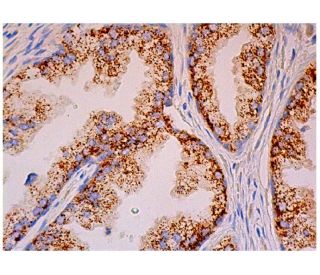 Arginase 2/ARG2 Antibody (A-10) - Immunohistochemistry - Image 334003 