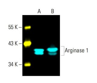 ARG1/Arginase 1 Antibody (E-2) - Western Blotting - Image 396273 