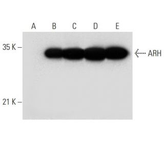 ARH Antibody (F-11) - Western Blotting - Image 314094 
