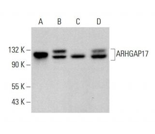 ARHGAP17 Antibody (G-6) - Western Blotting - Image 383307 