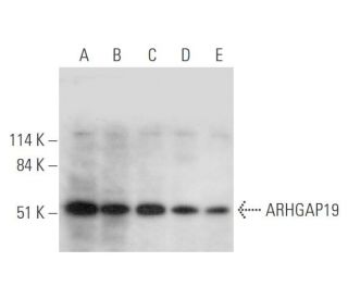ARHGAP19 Antibody (B-5) - Western Blotting - Image 333639 