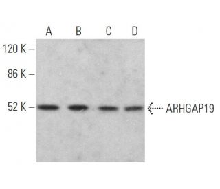 ARHGAP19 Antibody (B-5) - Western Blotting - Image 367185