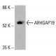 ARHGAP19 抗体 (B-5):sc-514960。通过蛋白质印迹分析 K-562 细胞总裂解物中 ARHGAP19 的表达。使用的检测试剂:m-IgG Fc BP-HRP:sc-525409。 ARHGAP19 Antibody (B-5) - Western Blotting - Image 415847
