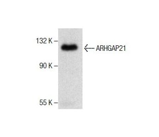 ARHGAP21 Antibody (E-10) - Western Blotting - Image 286740SAM Transcription Activation: SAM system utilizing dCas9-VP64, MS2-P65-HSF1, and sgRNA for precise gene transcription activation.