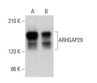 ARHGAP29 Antibody (D-3) - Western Blotting - Image 380170 